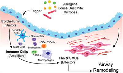 Airway Remodeling in Asthma